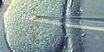 breveon3038